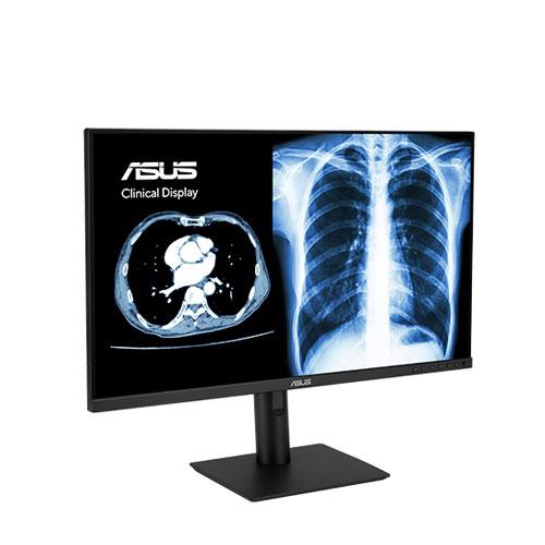 Asus MH2441A IPS Panel LCD Clinical Monitor price in hyderabad, telangana, nellore, vizag, bangalore